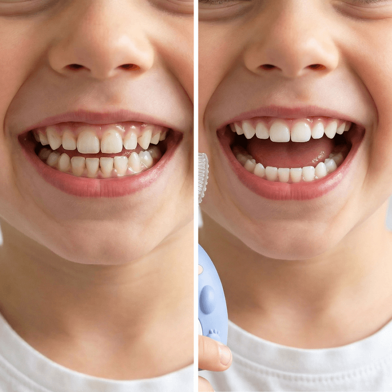 DinoBrush™ Kids Toothbrush